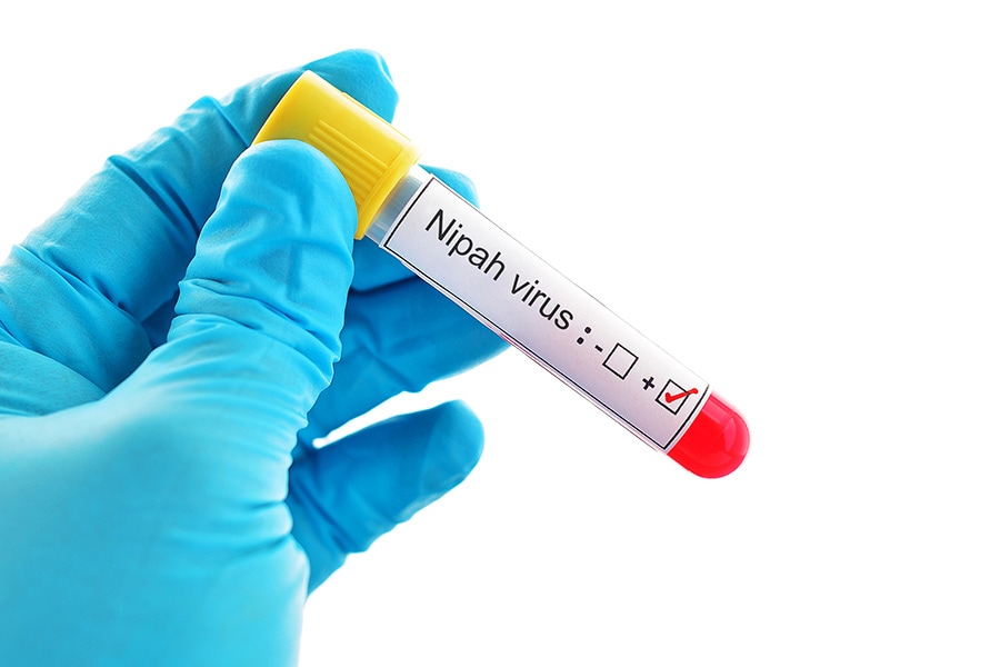 g_106563_nipah_virus_280x210.jpg