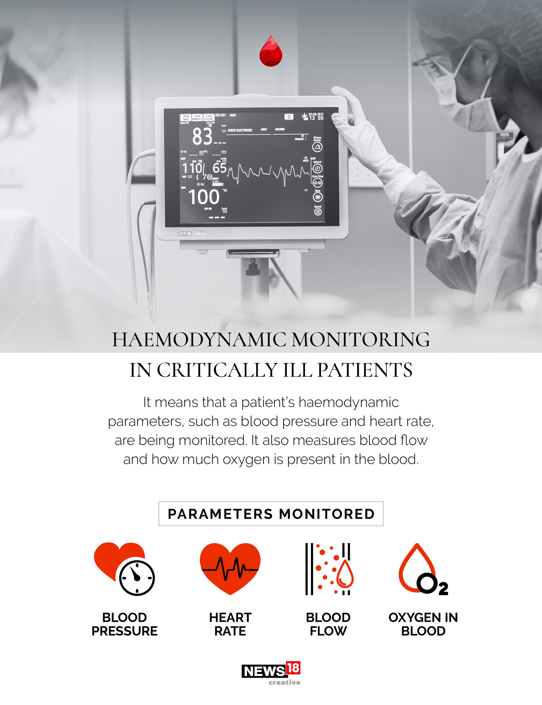 EXPLAINED: What is haemodynamic stability?