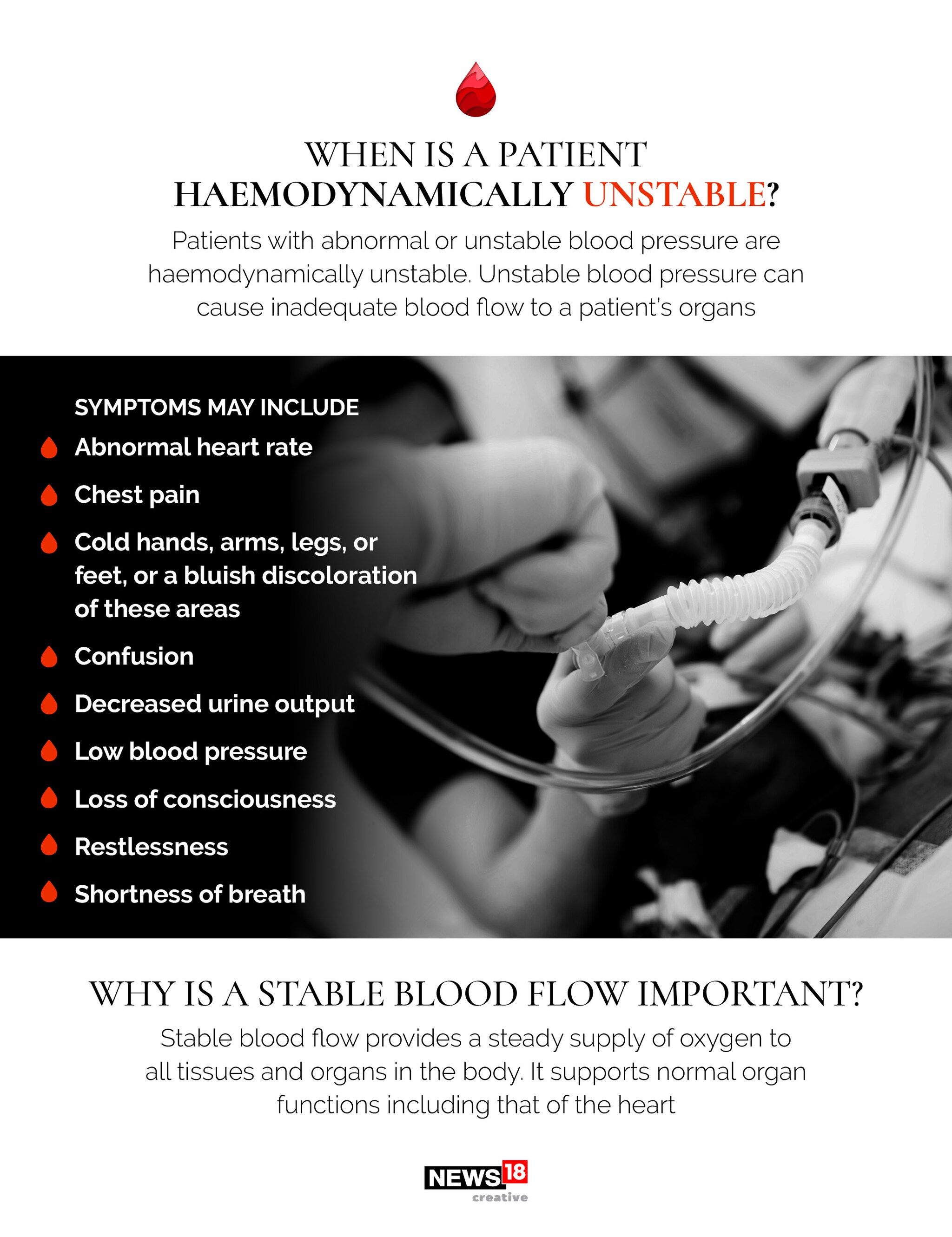 EXPLAINED: What is haemodynamic stability?