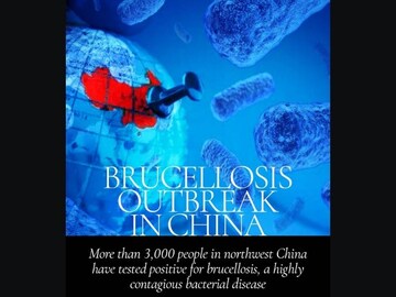 Brucellosis outbreak in China: What you need to know