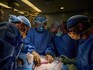 In a first, surgeons attach a pig kidney to a human—and it works