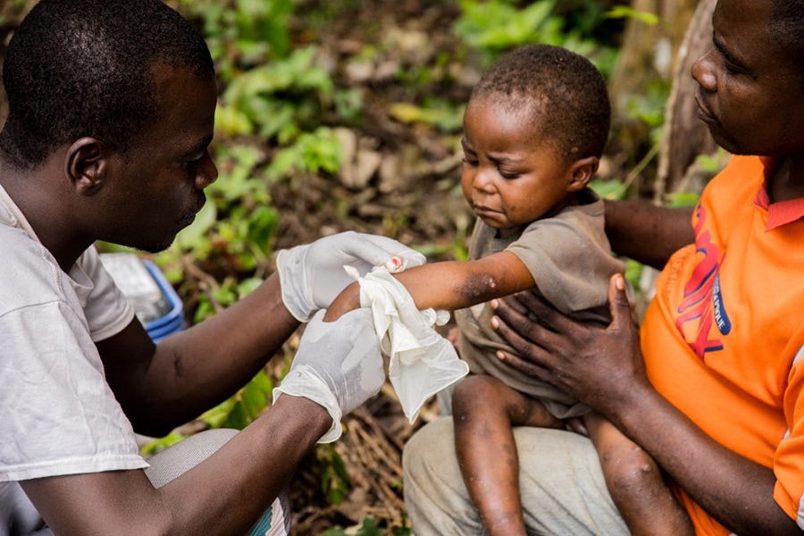 Rare monkeypox outbreaks detected in North America, Europe