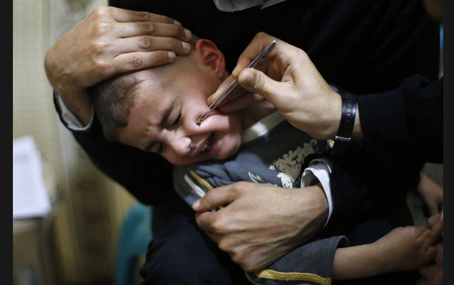 A Palestinian boy suffering from Paranasal sinus cries as he receives treatment at a bee venom thera