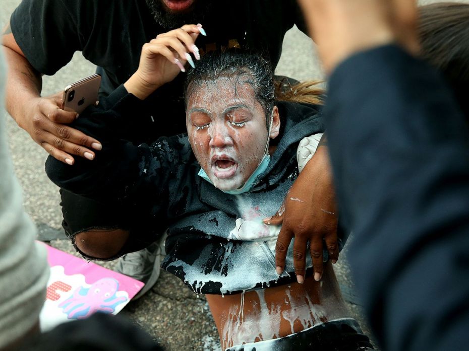 MINNEAPOLIS, MINNESOTA - MAY 31: A women who was hit with pepper spray had milk poured on her to eas