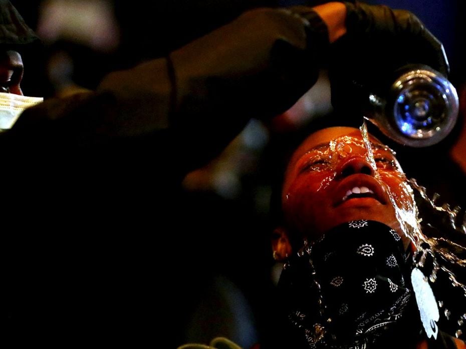 BOSTON, MASSACHUSETTS - MAY 31: A woman has her eyes rinsed with water during a protest, in response